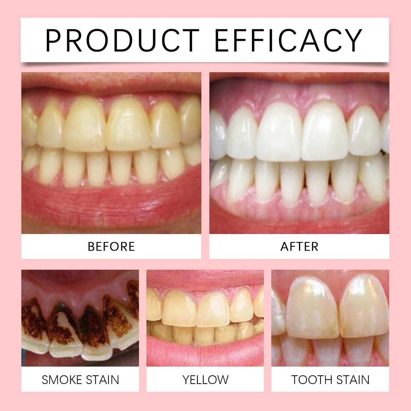 Whitening Toothpaste β Probiotic Stain Removal & Fresh Breath (1β5pcs)