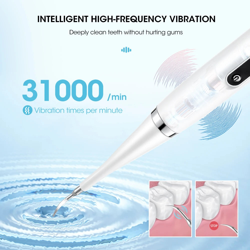 SonicSmile Pro β Electric Teeth Whitening & Tartar Removal Tool