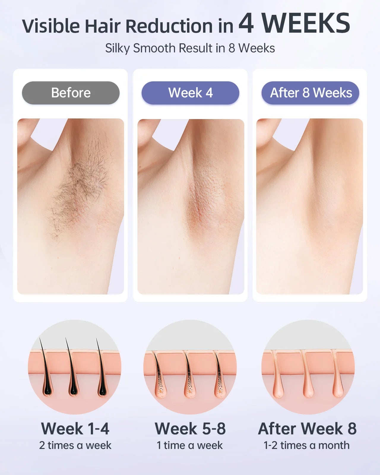 IPL Laser Hair Removal Device – 999,999+ Flashes for Safe, Long-Lasting Hair Reduction