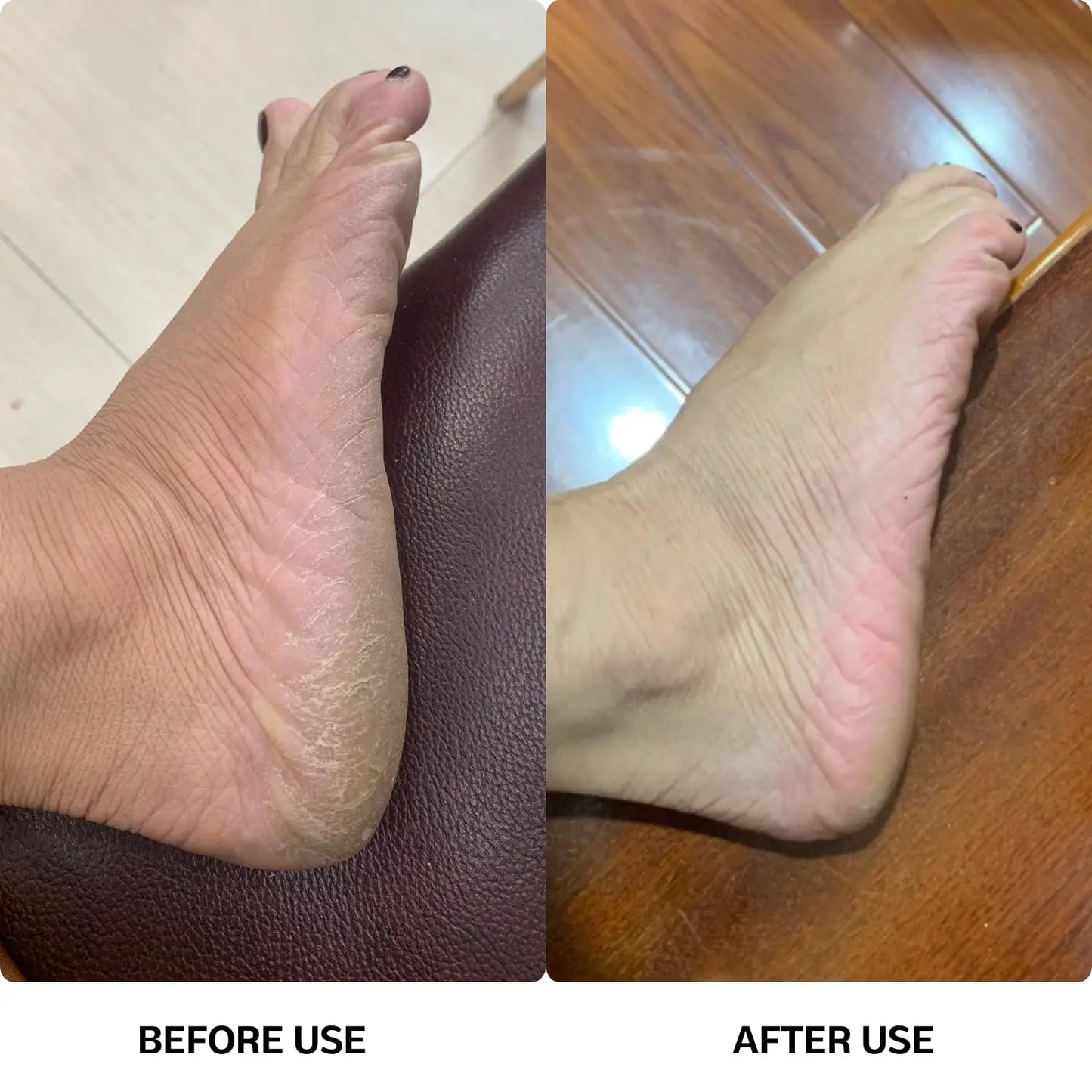 Electric Callus Remover with Speed Control – 60x Sandpaper Disks for Smooth Feet & Heels