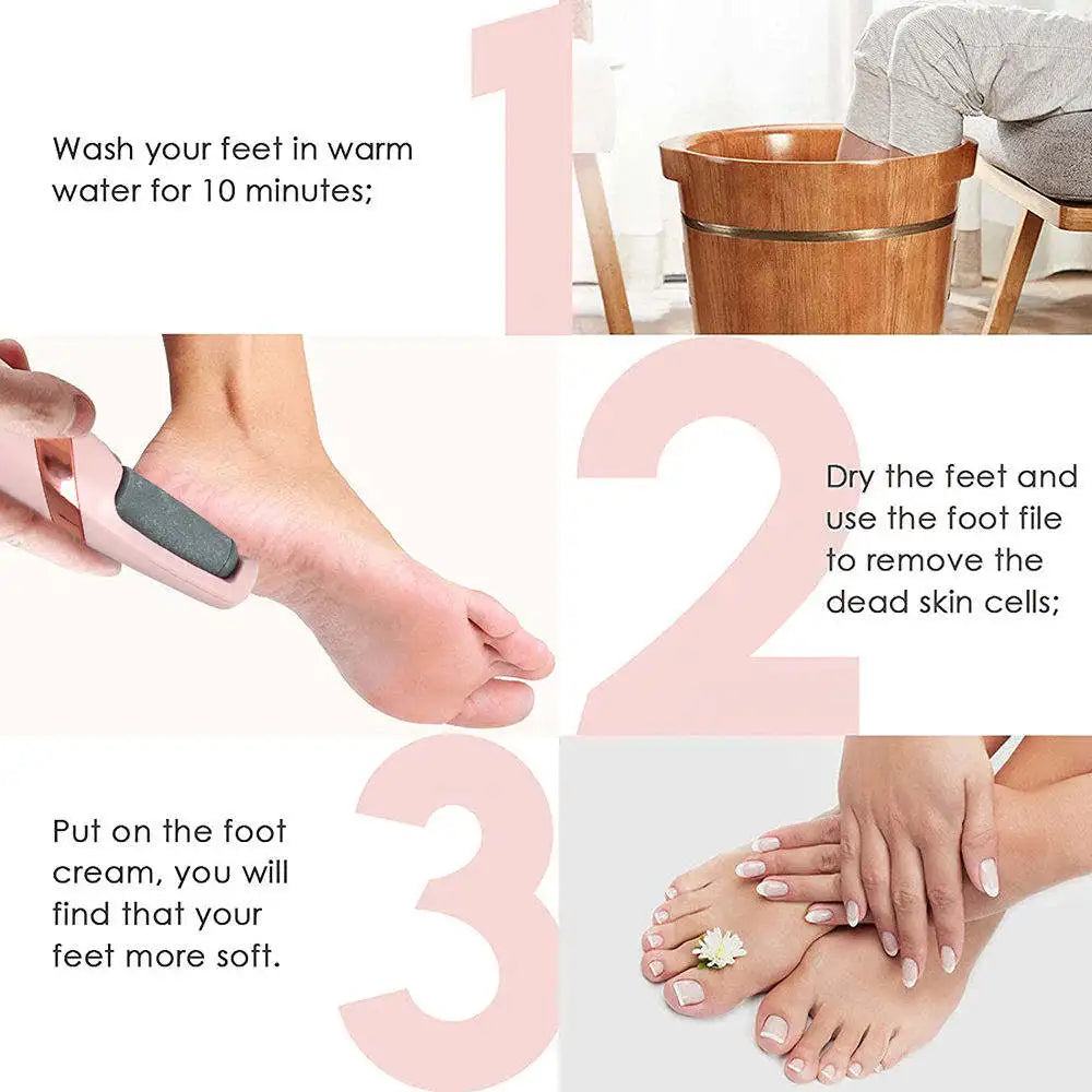 Rechargeable Electric Callus Remover – Cordless Foot File for Smooth Heels