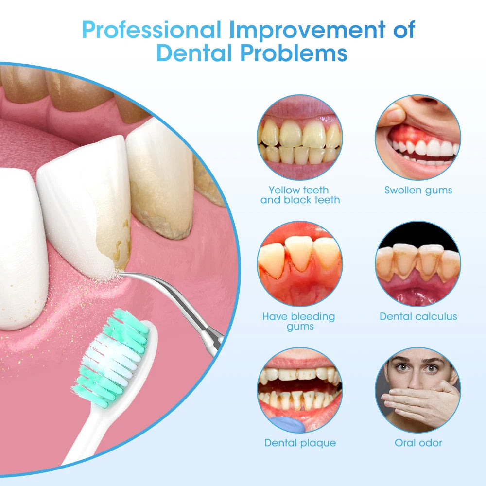 SonicSmile Pro – Electric Teeth Whitening & Tartar Removal Tool